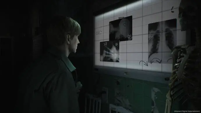 James Sunderland se dívá na některé rentgenové snímky na rentgenovém prohlížeči v remaku Silent Hill 2